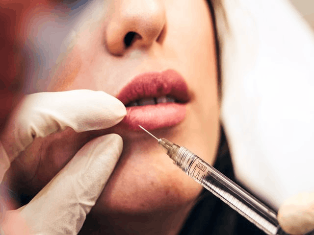 The Hidden Side Effect Of Lip Injection You Should Know