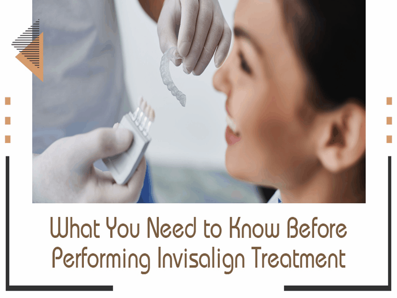 What You Need to Know Before Performing Invisalign Treatment