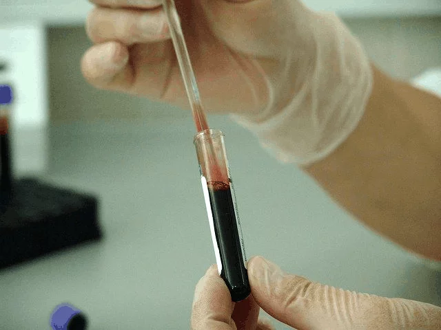 What To Expect From An Oncologist? 1 What To Expect From An Oncologist 1