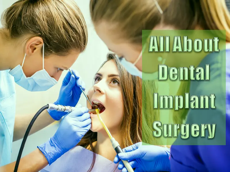 All About Dental Implant Surgery And It's Importance